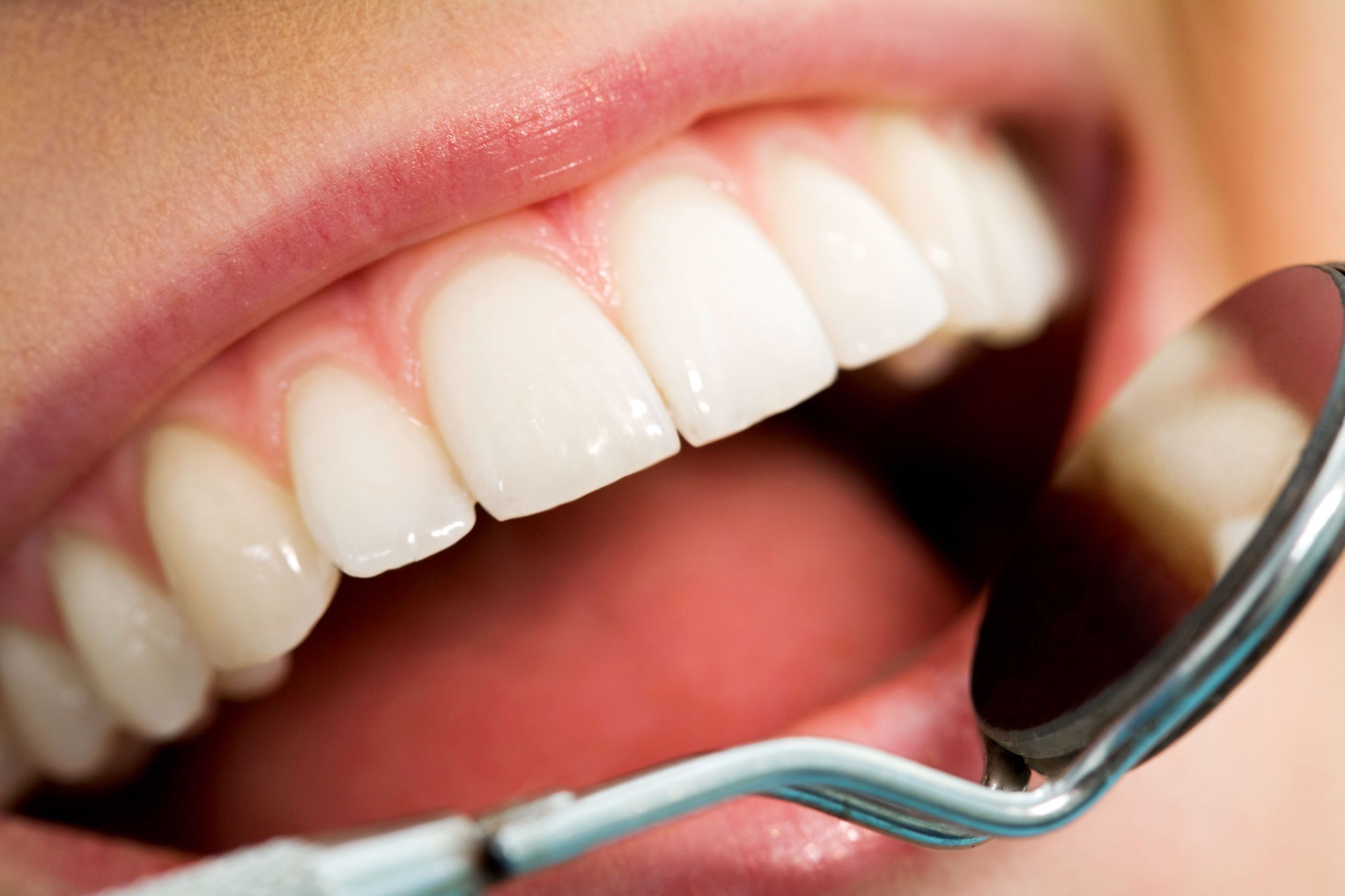 Keeping a Healthy Smile Is Easier When Using a Family Dentistry in Bloomfield, NJ