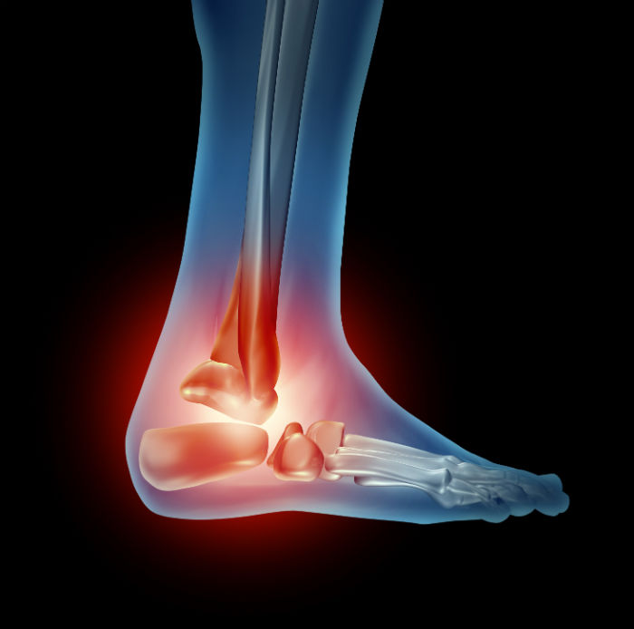 Reasons to Schedule a Visit to Ankle Specialists in Racine WI