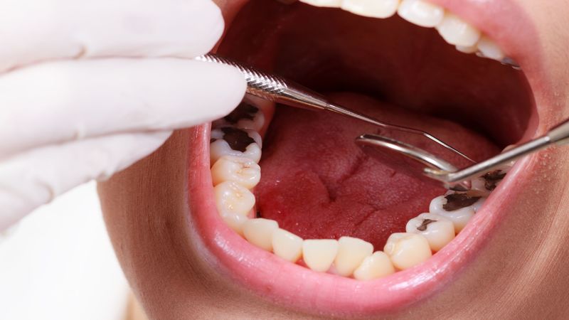 Natural Teeth Through the Process of Dental Implants at a Welland Office