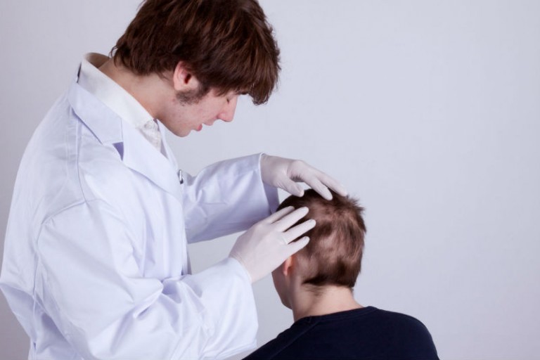 A Quick Guide to Surgical Hair Loss Treatment for Men in Mclean, VA