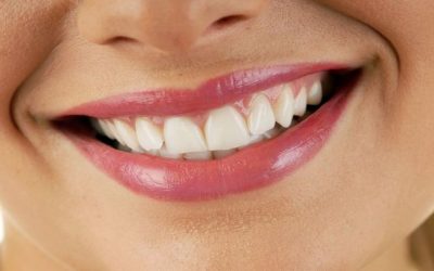 Smile bright with a top dentist in Kelowna: Comprehensive care options